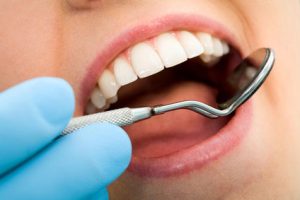 Periodontal Disease in Brooklyn